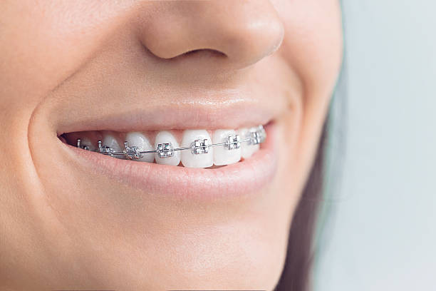 Dental Inlays and Onlays in Madeira Beach, FL